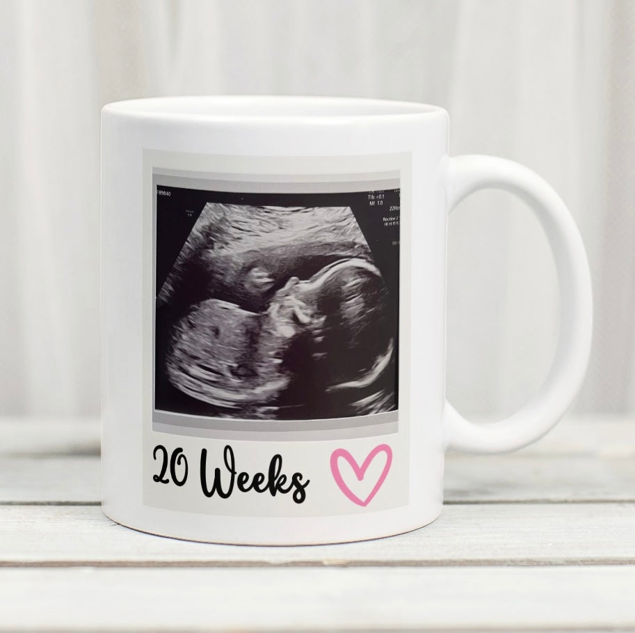 Baby Girl Personalised Scan Photo Mug